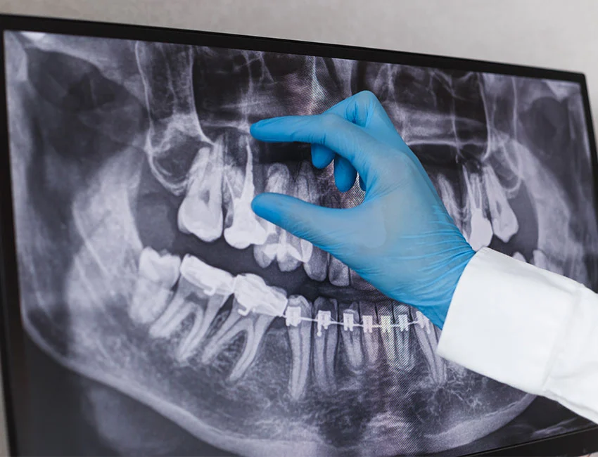 Dentist looking at root canal x-ray