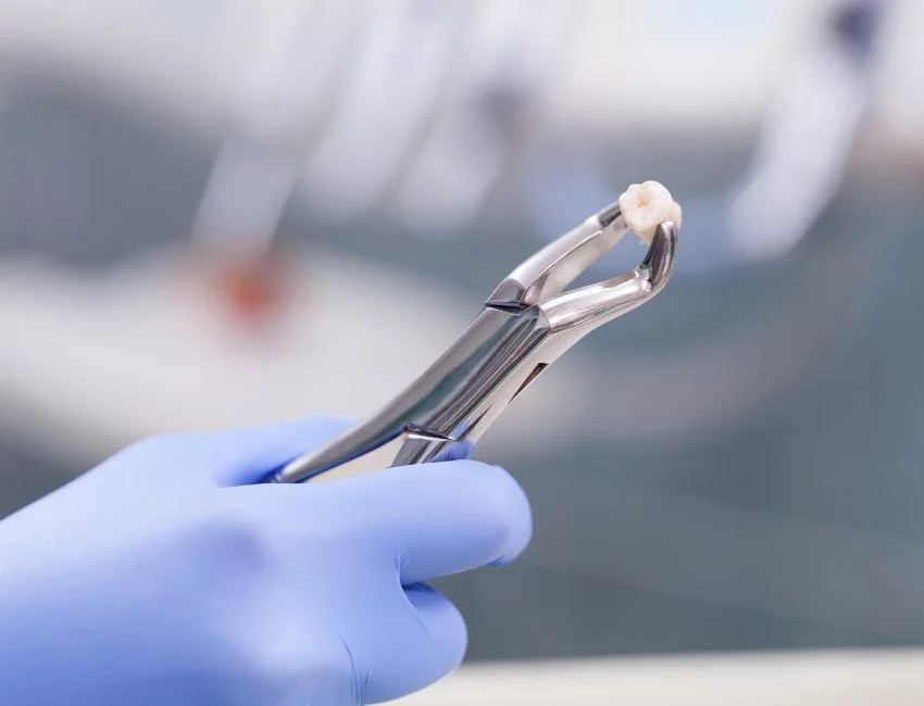 Dentist holding tooth after tooth Extraction