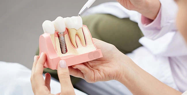 Dentist explaining dental implant procedure to patient