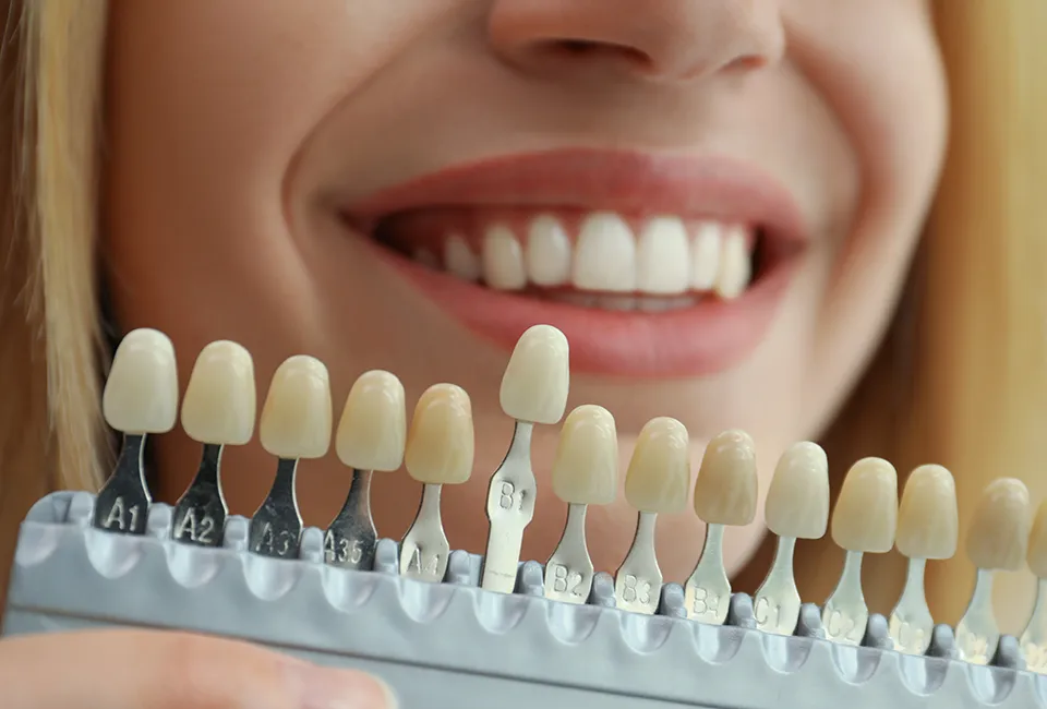 Teeth Whitening in La Jolla, CA